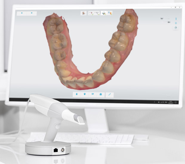 Beverly Hills 3D Cone Beam and 3D Dental Scans