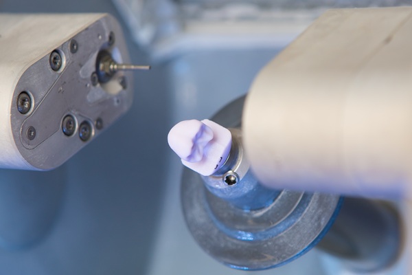 What Are CEREC® Crowns?