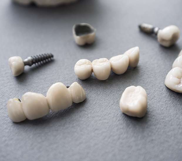 Beverly Hills The Difference Between Dental Implants and Mini Dental Implants