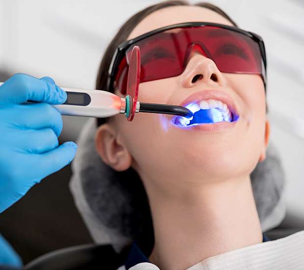 Beverly Hills Professional Teeth Whitening